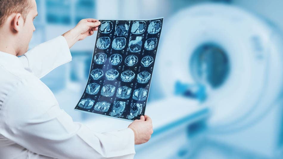 Médico estudiando una placa de tumor infantil